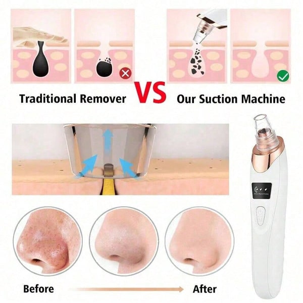 Zaavira™ Electric Acne Pore Cleaner & Blackhead Remover